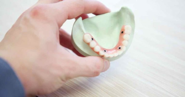 Does Medicare Cover Dental Implants